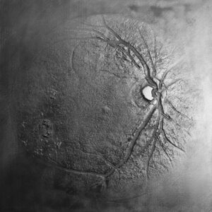 Retina, Pernille Sandberg - price on request